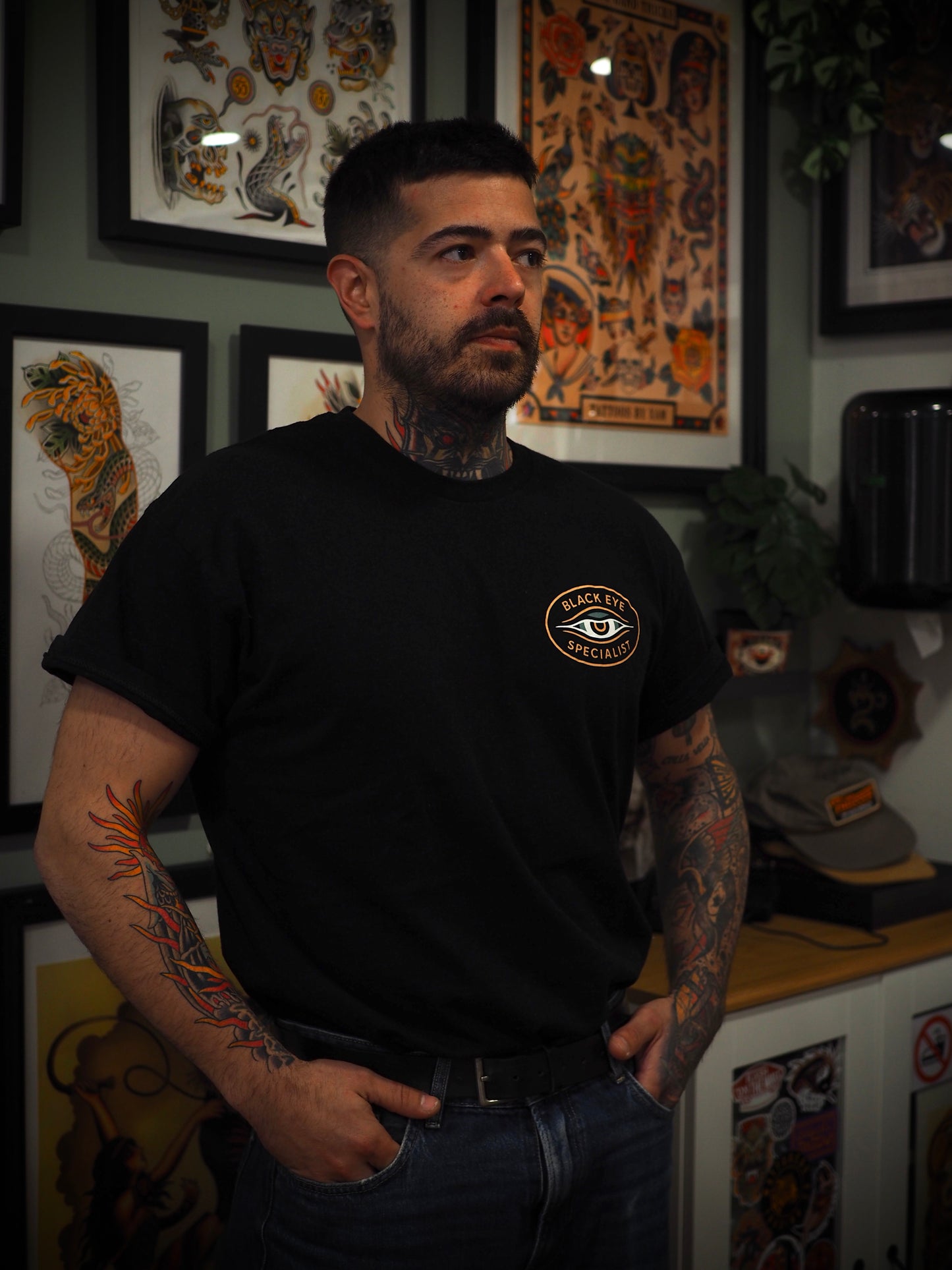 BLACK EYE SPECIALIST
